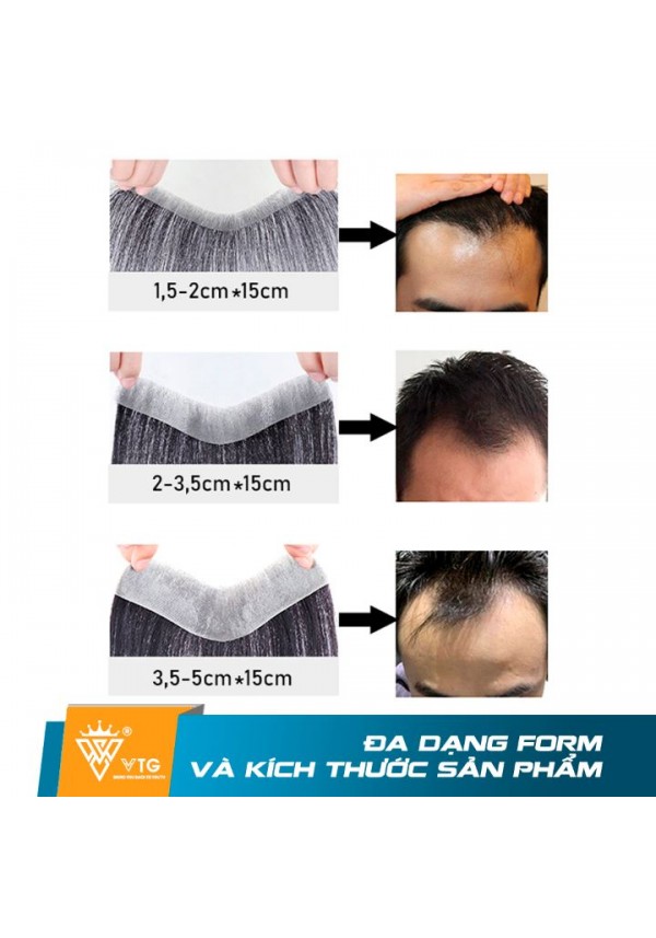 Tóc Giả Nam Mái M Nhỏ 1,2x16 CM - VTG D05